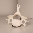 20210809_183416.jpg cervical human vertebrae