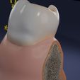 aa0016.jpg Corte esquemático de los dientes etiquetado