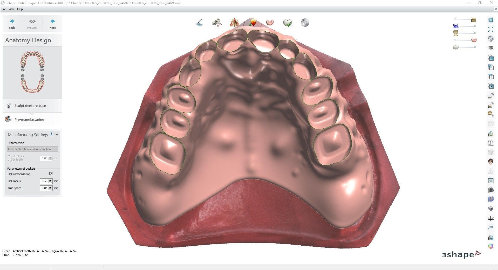 8.jpg Download OBJ file Digital Full Dentures for Gluedin Teeth with Manual Reduction • 3D printable design, LabMagic3DCAD