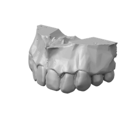 Maxilar-superior-1.png Upper jaw