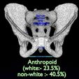 pelvis-types-hip-bone-labelled-detailed-3d-model-32ce8ab1a5.jpg Pelvis types hip bone labelled detailed 3D model