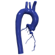 2.png 主动脉和冠状动脉 3D 模型 - 6 件装