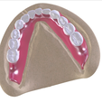 17.png Digital Full Dentures with Combined Glue-in Teeth Arch