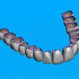 01.jpg Teeth for temporary crowns - maxillary-teeth