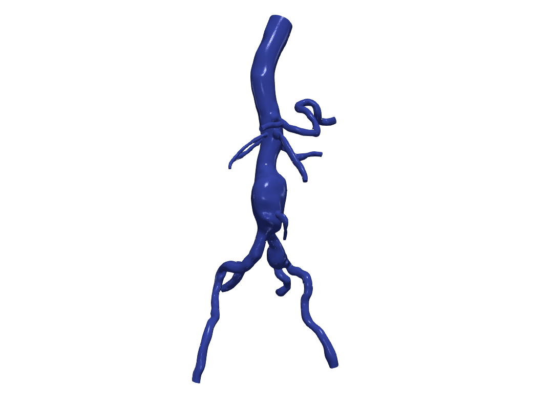 Download OBJ file 3d model of aorta and femoral arteries • Object to 3D ...