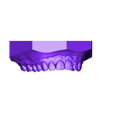 Maxillary.stl Digital Orthodontic Study Models with Virtual Bases