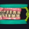 1-8.jpg Occlusion Teeth contact points