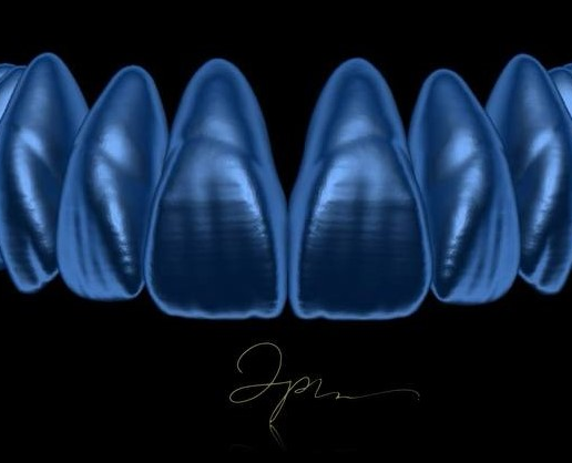 preview.png JP Natural Shape Design Library Teeth - EXOCAD