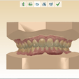 Screenshot_1.png STL file Digital Orthodontic Study Models with Virtual Bases・3D printing idea to download