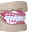 2.png Digital Full Dentures with Combined Glue-in Teeth Arch
