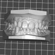 JOEL-LEYVA.jpg Dental Model/ Dental Model