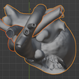 13.png 3D Model of Heart after Fontan Procedure