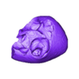 STL00005.stl 3D Model of Human Heart with Double Outlet Right Ventricle (DORV) - generated from real patient