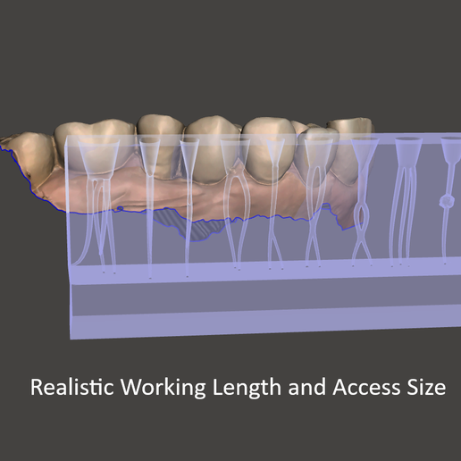 🦷 RCT Practice Block・Archivo STL para Impresión 3D・Cults