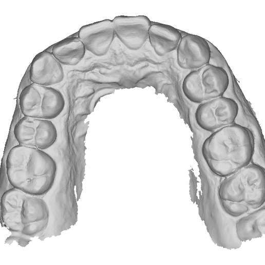 🩻 P002 - Dental - Intraoral Scan STL-PLY-OBJ・ STL File for 3D printing ...