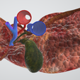 FATTY-LIVER,-Steatosis,-Steatohepatitis,-abdominal,-abdomen,-pancreatic,-biliary,-hepatic,-artery,.png 6 PIÈCES Modèle 3D réaliste du foie gras - avec système biliaire, veines portales, veines et artères hépatiques, ligaments du foie