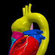 3.png Modèle 3D de la valve aortique bicuspide (BAV)
