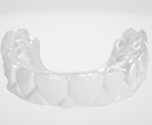🦷 High resolution ESSIX Dental Appliance・ STL File for 3D printing・Cults