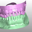 Imagen1.png Complete dental model