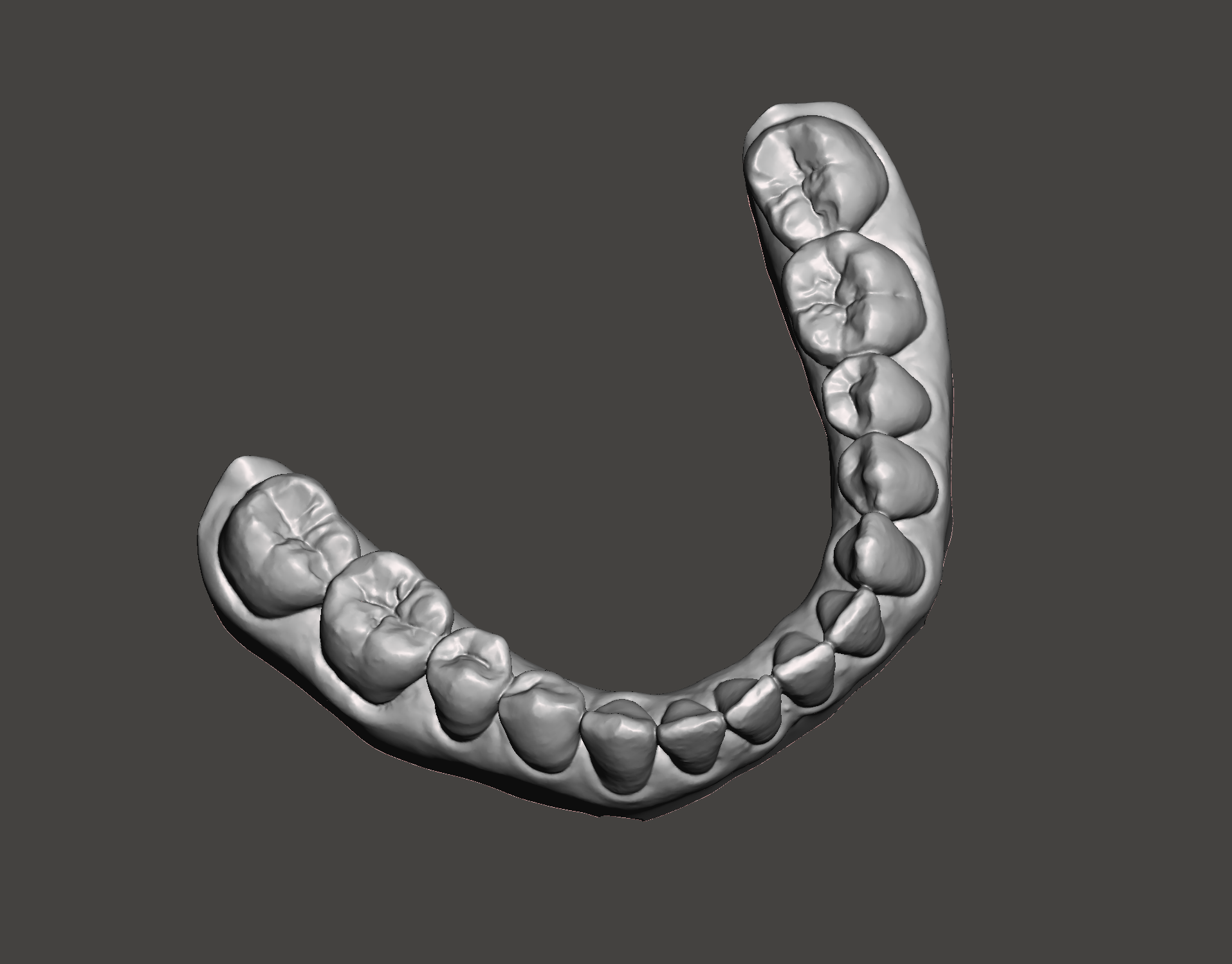 STL File Dental Models・3D Print Design To Download・Cults