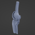 K2.png Knee Replacement