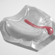 Dental-I-Spacer-2.png ESPACIADOR DENTAL COLECCIÓN 1