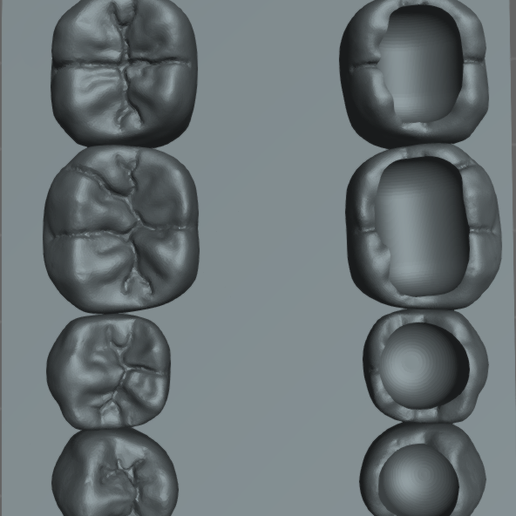 Captura-de-pantalla-2025-12-30-010502.png Untere Modelldichtungen