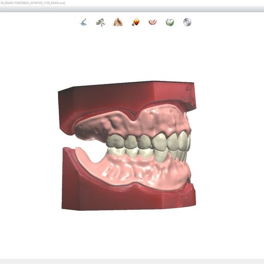 2.jpg Download OBJ file Digital Full Dentures for Gluedin Teeth with Manual Reduction • 3D printable design, LabMagic3DCAD