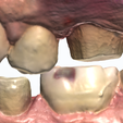 IO-Data-Pack-Pic-III.png Dental Design Practice - Intraoral  Scans