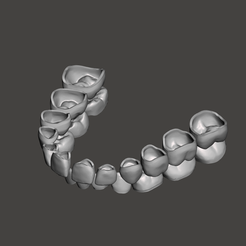 meshmixer_dOZv4qwPkw.png STL-Datei Pädiatrische Zahnschalen・3D-druckbare Vorlage zum herunterladen