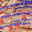 centralnervoussystemcortexlimbicbasalgangliastemcerebel3dmodelblend18.jpg Central nervous system cortex limbic basal ganglia stem cerebel 3D model