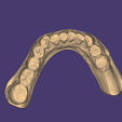 OCLUSAL-INF-ORIGINAL.png ENCERADO / MOCK-UP #2