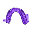 789513050_20240104_1632_Tech_01_bruxi_UnsectionedModel_UpperJaw.stl BANDEJA DE BRUXISMO DIGITAL - 3 archivos stl (prueba+modelo+antagonista)