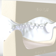 3.png Digital Try-in Full Dentures for Injection Molding