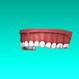 7.jpg Set of Teeth Dental Model