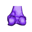 knee1_obj.obj 3D Model of Knee - generated from a real patient