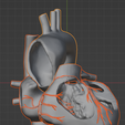 24.png Modèle 3D de la valve aortique bicuspide (BAV)