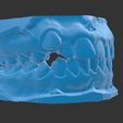 2.jpg Pediatric dental model with irregular dentition