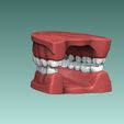4.jpg Set of Teeth Dental Model