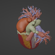 5.png 3D Model of Healthy Human Heart - generated from real patient