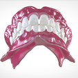 Screenshot_19.png Digital Full Dentures for Gluedin Teeth with Manual Reduction