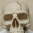 Cracked-Skull_Rechts_Photo2.jpg Расколотый череп - Башня из кубиков