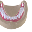 14.png Digital Full Dentures with Combined Glue-in Teeth Arch
