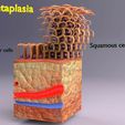 adaptation-epithelial-cell-changes-normal-to-cancer-3d-model-010a82012c.jpg adaptation epithelial cell changes normal to cancer Low-poly 3D model