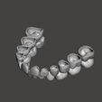 meshmixer_dOZv4qwPkw.png Pediatric Teeth Shells
