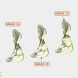 normal pelvis GRADE 2A GRADE 1 GRADE 2C GRADE 2B GRADE 3B GRADE 3A Paprosky Classification of Acetabular Bone Loss