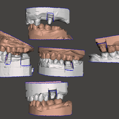 Sample-Pack-A.png 3D file Sample Data for Dental Design Practice・3D printer design to download