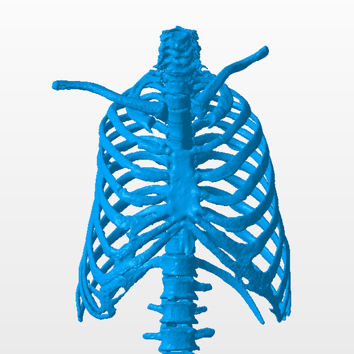 🩻 RIBS DEFECT MODEL FULL・ STL File for 3D printing・Cults