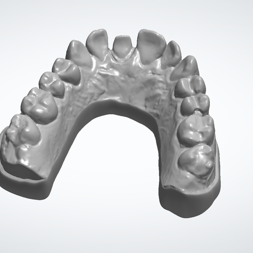 👑 Upper Jaw Dental Model Crown 11・ STL File for 3D printing・Cults
