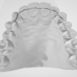 Fix-lingual-retainer-1.png High resolution Fix Lingual Retainer Dental Appliance